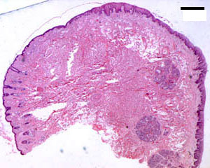 Hard Palate Histology