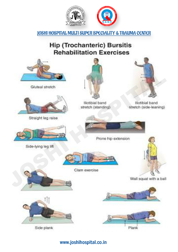 Hip Bursitis PT Exercises