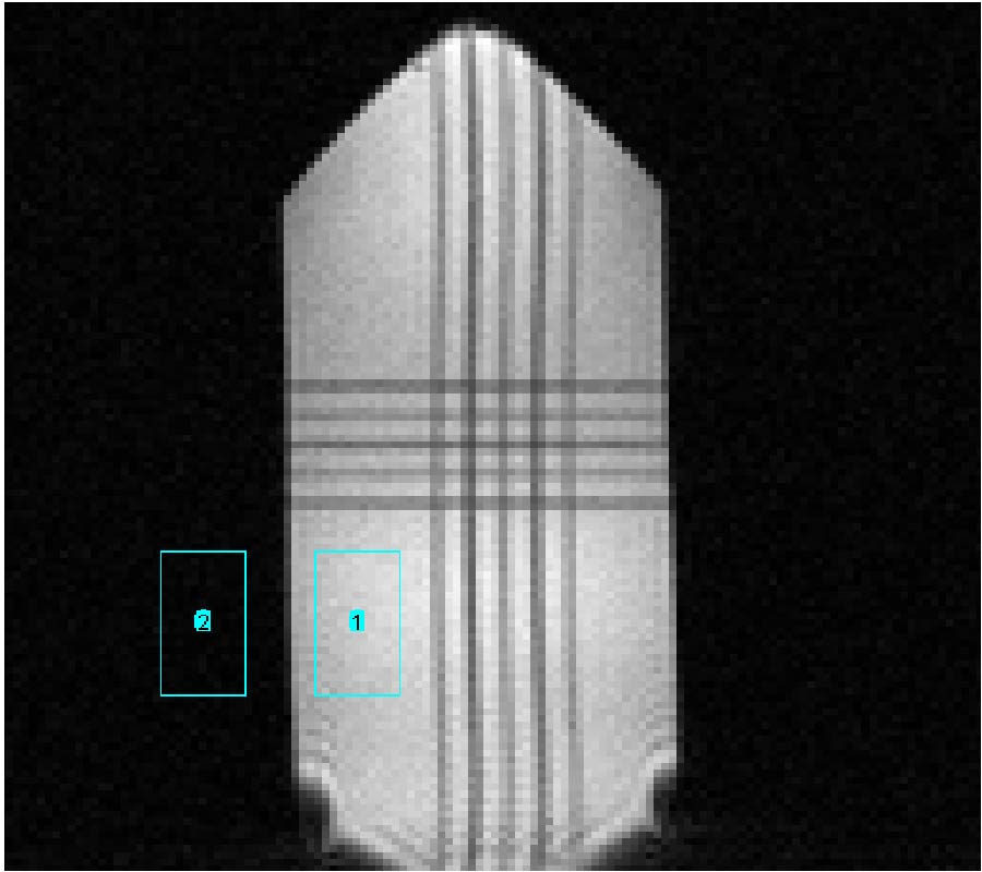 THE SERIAL RESONANT ANTENNA FOR THE LARGE FIELD OF VIEW MAGNETIC RESONANCE IMAGING