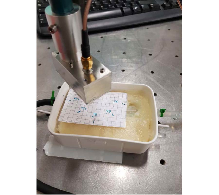 EXPERIMENTAL FEASIBILITY STUDY OF USING MM-WAVE FOR ARTERIAL RADIAL DISPLACEMENT MONITORING