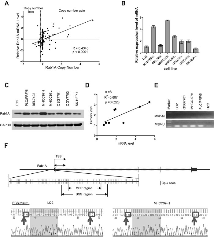 Rab1A is overexpressed in HCC due to copy number increase.