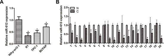 miR-613 is downregulated in PTC cell lines and patient specimens.