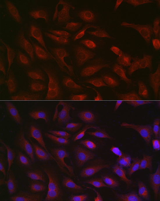 GSDMD (Full length+C terminal) Polyclonal Antibody