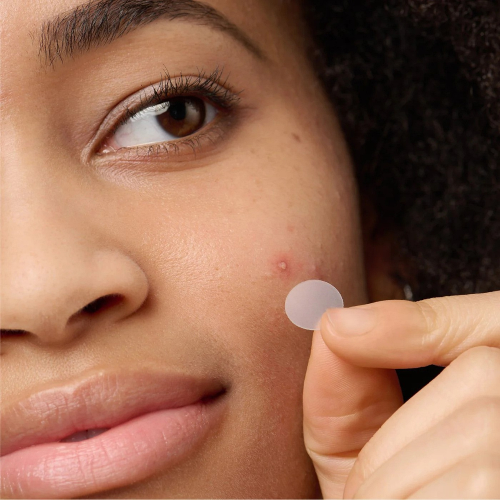 how-do-pimple-patches-work-woman-holding-pimple-patch-on-face