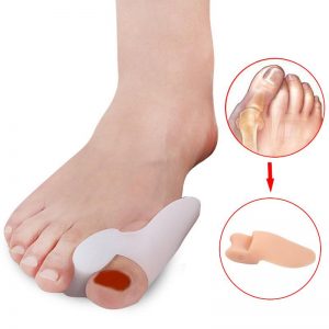 Bunion Splint