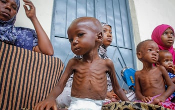 The report highlights that child malnutrition is not just a human tragedy, but an economic one as well