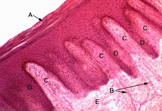 Oral Histology Digital Lab Mucosa Mucosa Of The Soft - vrogue.co