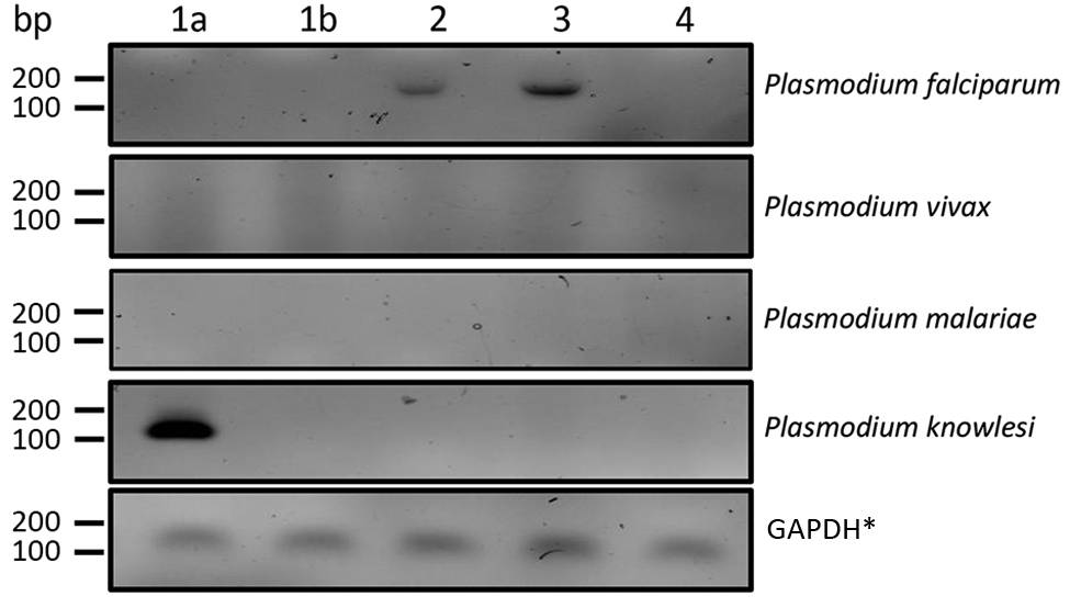 Nested PCR of Plasmodium knowlesi DNA isolated from a patient in Poland with recent travel to Southeast Asia. Lane 1a, patient sample from day of admission; lane 1b, patient sample taken 11 days after implementing malarial treatment; lanes 2 and 3, samples taken from patients previously diagnosed with Plasmodium falciparum malaria; lane 4, sample from an afebrile person from Poland with no history of travel to tropical countries. *GAPDH, glyceraldehyde 3-phosphate dehydrogenase.