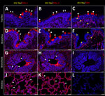 Respiratory tract tissues from a US dairy cow infected with highly pathogenic avian influenza A(H5N1) virus, labeled with IAV-Np (yellow pseudocolor, DyLight 594), individually duplexed with MAL-I (red pseudocolor, Alexa Fluor 647), MAL-II (red pseudocolor, Alexa Fluor 647), and SNA (red pseudocolor, Alexa Fluor 647) using fluorescent staining. Representative merged images are shown for IAV-Np and MAL-I (A, D, G, J), IAV-Np and MAL-II (B, E, H, K), and IAV-Np and SNA (C, F, I, L). IAV-Np labeling was not detected within the respiratory tissue sections. Intense, granular to punctate, cytoplasmic MAL-I, MAL-II, and SNA labeling was observed in goblet cells (arrowheads) and glands of the trachea (A–C). Similar goblet cell labeling (arrowheads) for MAL-I (D) and MAL-II (E) was observed in the bronchi with weak SNA labeling (F). Multifocal, moderate, fibrillar, apical, membranous MAL-I (A) and MAL-II (B) labeling (white arrows) was observed on the tracheal epithelium. The respiratory epithelium of the bronchi, bronchioles, and alveoli had diffuse, moderate to intense, apical, fibrillar MAL-I labeling (white arrows) (D, G, J). The respiratory epithelium of the bronchi had multifocal, moderate, fibrillar, apical MAL-II labeling (white arrows) (E). The respiratory epithelium of the bronchioles and alveoli had diffuse MAL-II labeling (white arrows) (H, K). Intraluminal secretory material (asterisks) in the bronchi and bronchioles were intensely labeled with MAL-I and MAL-II (G, H). Membranous, granular SNA labeling (yellow arrows) was observed in intraepithelial and lamina proprial round cells in the trachea and bronchi (C, F). Scale bars indicate 50 μm. IAV-Np, influenza A virus nucleoprotein; MAL, Maackia amurensis lectin; SNA, Sambucus nigra lectin. 