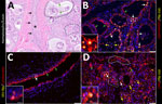 Infected region of the mammary gland from a US dairy cow infected with highly pathogenic avian influenza A(H5N1) virus, labeled with IAV-Np (yellow pseudocolor, DyLight 594), individually duplexed either with epithelial marker pan-cytokeratin (red pseudocolor, Alexa Fluor 647) (B, C) or macrophage or monocytic marker ionized calcium binding adaptor molecule 1 (Iba1) (red pseudocolor, Alexa Fluor 647) (D) using fluorescent labeling. A representative image from a hematoxylin and eosin stain section highlights the cellular architecture of the affected mammary gland (A). Unaffected secretory alveoli were observed in the section (solid black outline). Secretory alveoli variably contain eosinophilic proteinaceous material and corpora amylacea. The secretory alveoli were lined by cuboidal epithelial cells (green arrows) that were variably vacuolated. A few secretory alveoli were disrupted by inflammation (macrophages and neutrophils) and epithelial necrosis (dashed black outline). A single interlobular duct (black asterisk) lined by a bilayer of low cuboidal epithelial cells (black arrows) was observed. The duct contains eosinophilic proteinaceous fluids with scattered inflammatory cells (macrophages and neutrophils) and sloughed epithelium (A). Epithelial cells lining secretory alveoli (B) and interlobular ducts (C) were labeled with pancytokeratin as expected. IAV-Np intranuclear co-labeling (white arrows) in epithelial cells lining the secretory alveoli (B) and ducts (C). Intraluminal cells within secretory alveoli had intranuclear IAV-Np labeling (yellow arrows) that variably co-labeled with pan-cytokeratin. Likewise, Iba1 labeling (green arrows) was observed in the lumens of secretory alveoli or interlobular (alveolus labeling highlighted by white dotted outline) and interstitium (highlighted by the solid white outline) (D). Iba1 labeling was intense, diffuse, and cytoplasmic. IAV-Np intranuclear and intracytoplasmic labeling was less commonly co-labeled within Iba1 labeled cells (white arrows) (D). IAV-Np labeling was not observed in Iba1-labeled cells in the interstitium solid white outline). Insets highlight intranuclear labeling in panels C, B, and D, and the white boxes in the corresponding images represent the origin of the inset image. Scale bars indicate 200 μm (A), 50 μm (B, C, D), and 20 μm (insets). IAV-Np, influenza A virus nucleoprotein; Iba1, ionized calcium binding adaptor molecule 1.