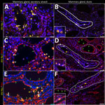 Infected region of the mammary gland from a US dairy cow infected with highly pathogenic avian influenza A(H5N1) virus, labeled with IAV-Np (yellow pseudocolor, DyLight 594), individually duplexed with MAL-I (red pseudocolor, Alexa Fluor 647), MAL-II (red pseudocolor, Alexa Fluor 647), and SNA (red pseudocolor, Alexa Fluor 647) using fluorescent staining. Representative merged images of IAV-Np/MAL-I (A, B), IAV-Np/MAL-II (C, D), and IAV-Np/SNA (E, F) are shown. Moderate to intense intranuclear and intracytoplasmic IAV-Np labeling (yellow, white arrows) was observed in epithelial cells lining the secretory alveolus of the mammary gland; however, no MAL-I labeling was detected (A). Rare, moderate intranuclear IAV-Np labeling (yellow, white arrows), but no MAL-I labeling was observed in epithelial cells lining the interlobular duct (solid white outline) (B). Intense, apical, fibrillary MAL-II labeling (green arrows) was observed in the epithelial cells lining the secretory alveoli of infected mammary glands (C). IAV-Np labeling was co-labeled with MAL-II in individual epithelial cells (white arrows). IAV-Np labeling (white arrows) was observed in epithelial cells of interlobular ducts (solid white outline) (D). MAL-II labeling was not observed in interlobular ducts but was detected in the unaffected secretory alveoli (dashed white outline) (D). Intraluminal cells with cytoplasmic MAL-II labeling were observed (yellow arrow) (D). Intense, apical, granular, membranous to cytoplasmic SNA labeling (green arrows) was observed in the epithelial cells lining the secretory alveoli of infected mammary glands (E). IAV-Np intranuclear labeling was co-labeled with SNA in individual epithelial cells (white arrows) in the secretory alveoli (E). SNA (green arrows) and IAV-Np (white arrows) were observed in epithelial cells of the interlobular ducts (dashed or solid white outline) and were co-labeled to individual ductal epithelial cells (F). Sloughed intraluminal cells had membranous SNA labeling (yellow arrows). Adjacent secretory alveoli had prominent SNA labeling (dashed white outline). The dotted white outline highlights a severely affected secretory gland (F). Insets highlight white boxed areas in panels B, D, and F. Scale bar indicate 20 μm (A, C, E), 50 μm (B, D, F), and 20 μm (insets). IAV-Np, influenza A virus nucleoprotein; MAL, Maackia amurensis lectin; SNA, Sambucus nigra lectin.