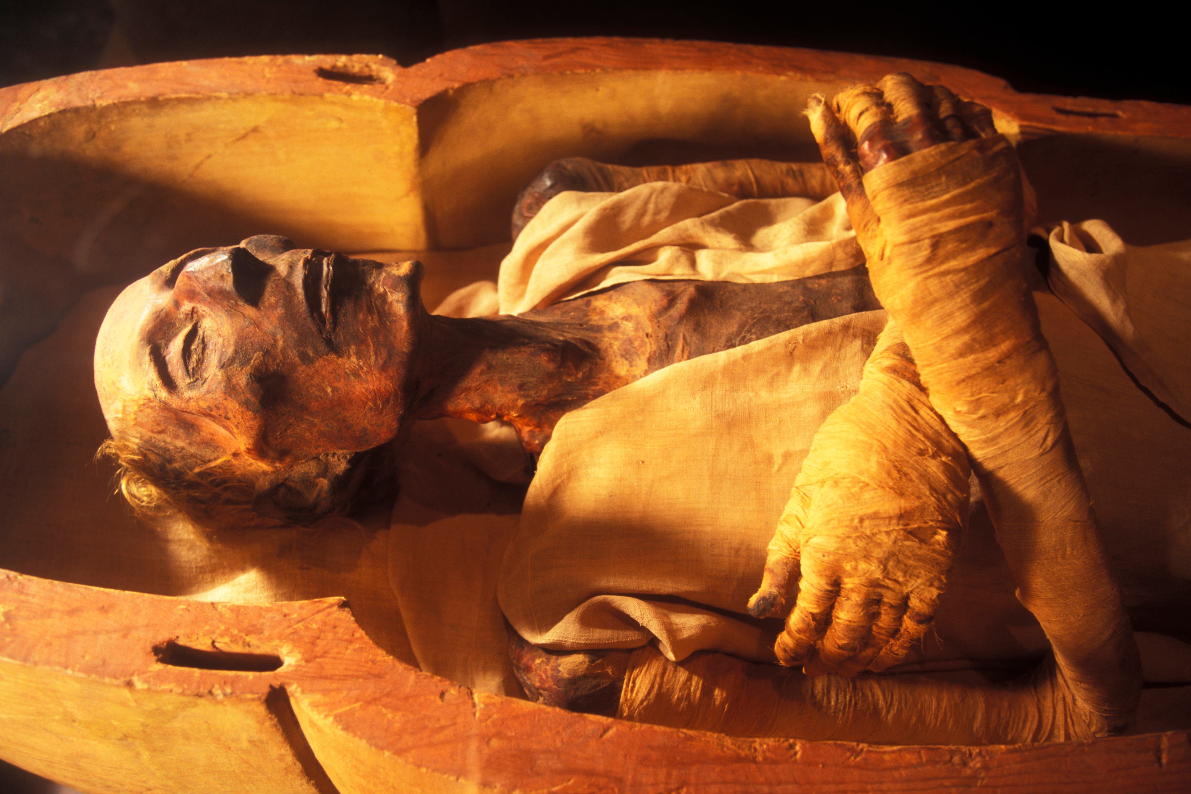 Ramses II’s Mummy