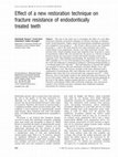 Research paper thumbnail of Effect of a new restoration technique on fracture resistance of endodontically treated teeth