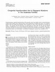 Research paper thumbnail of Congenital Hypothyroidism due to Oligogenic Mutations in Two Sudanese Families