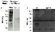 Research paper thumbnail of Supplementary Figure 1 from Enhanced Immune Recognition of Cryptic Glycan Markers in Human Tumors