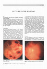 A cautionary tale: Terson's syndrome presenting to eye casualty Cover Page