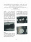 Research paper thumbnail of Dermatofibrosarcoma protuberans--a rare variant of soft tissue sarcoma of skin. An experience of two cases at Ayub Teaching Hospital Complex (ATHC), Abbottabad