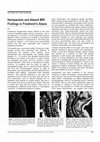 Hemiparesis and Absent MRI Findings in Freidreich's Ataxia Cover Page