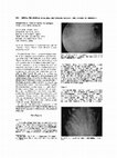 Preretinal White Dots in Adult-Type Gaucher Disease Cover Page