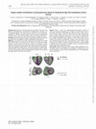 Research paper thumbnail of Unique cardiac remodeling in young adults born Small for Gestational Age with subsequent central obesity