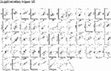 Research paper thumbnail of Supplementary Figure S6 from Radiotherapy of Human Sarcoma Promotes an Intratumoral Immune Effector Signature