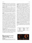 Kawasaki Disease Specific Optical Coherence Tomography (Oct) Findings Cover Page