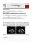 Research paper thumbnail of Acquired Valsalva sinus pseudoaneurysm after aortic valve replacement