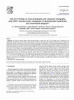 Research paper thumbnail of Mid-term findings on echocardiography and computed tomography after RVOT-reconstruction: comparison of decellularized (SynerGraft) and conventional allografts