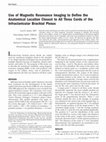 Research paper thumbnail of Epidural Pain Relief Versus Systemic Opioid-Based Pain Relief for Abdominal Aortic Surgery