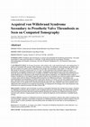 Acquired von willebrand syndrome secondary to monoclonal gammopathy of undetermined significance: long-term remission after treatment with bortezomib Cover Page