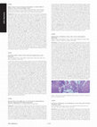 Tu1886 Adipose Tissue Is Toxic for Pancreatic Parenchyma: Co-Culture Model of Pancreatic Tissue and Visceral Adipose Tissue Cover Page