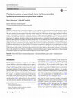 Painful stimulation of a sensitized site in the forearm inhibits ipsilateral trigeminal nociceptive blink reflexes Cover Page