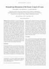 Research paper thumbnail of Desmoid-type fibromatosis of the breast: A report of 2 cases