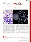 Secondary AML with MLL gene amplification Cover Page