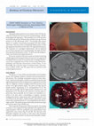 <i>BRAF</i> V600E Mutation in Two Distinct Meningeal Melanocytomas Associated With a Nevus of Ota Cover Page