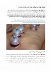 Cupping is better or fasding Cover Page