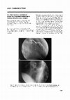 Left main coronary spontaneous dissection: Progressive angiographic healing without coronary surgery Cover Page