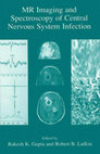 MR Imaging and Spectroscopy of Central Nervous System Infect Cover Page