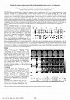 Research paper thumbnail of Finding the optimal sampling pattern in 2D parallel imaging for a given receiver coil configuration