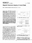 Research paper thumbnail of Magnetic resonance imaging of human teeth