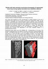 Research paper thumbnail of Studies with high resolution synchrotron-tomography of regenerated bone tissue using rapidly resorbable bone substitute materials