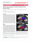 Research paper thumbnail of Vortex ring mixing in the left ventricle of the human heart