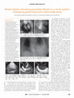 Research paper thumbnail of Breast implant mimicking pericardial effusion in a cancer patient undergoing gated heart pool radionuclide study