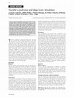 Research paper thumbnail of Tourette’s syndrome and deep brain stimulation