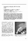 Research paper thumbnail of Sclerosing cholangitis with neonatal onset