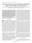 Research paper thumbnail of Atlas-based segmentation of pathological MR brain images using a model of lesion growth