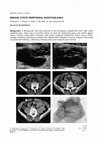 Research paper thumbnail of Benign Peritoneal Cystic Mesothelioma