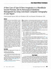 A Rare Case of Type III Dens Invaginatus in a Mandibular Second Premolar and Its Nonsurgical Endodontic Management by Using Cone-beam Computed Tomography: A Case Report Cover Page