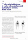 Research paper thumbnail of 99m Tc-Octreotide-Avid Brain Mass In A Patient With Poorly Differentiated Papillary Thyroid Carcinoma, Hope In Despair