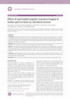 Research paper thumbnail of Effects of axial-loaded magnetic resonance imaging of lumbar spine on dural sac and lateral recesses